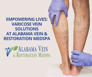 Empowering Lives: Varicose Vein Solutions at Alabama Vein & Restoration Medspa